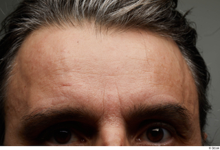 HD Face Skin Benito Romero eyebrow face forehead scar skin…